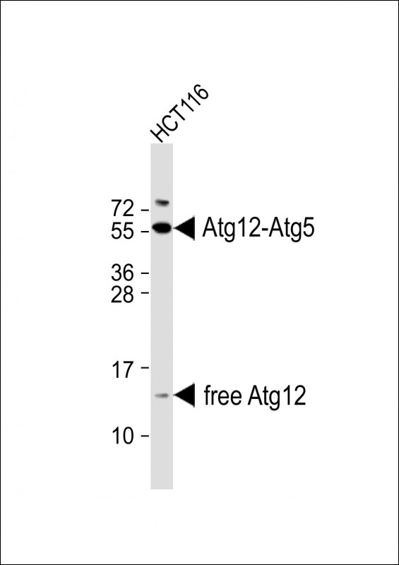 Rabbit Polyclonal Antibody to ATG12 (N-term)