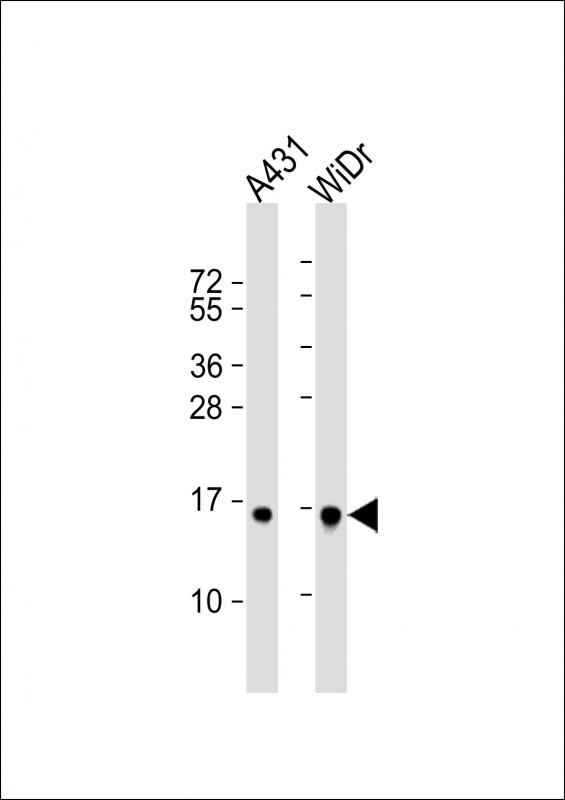 Rabbit Polyclonal Antibody to H2BFS