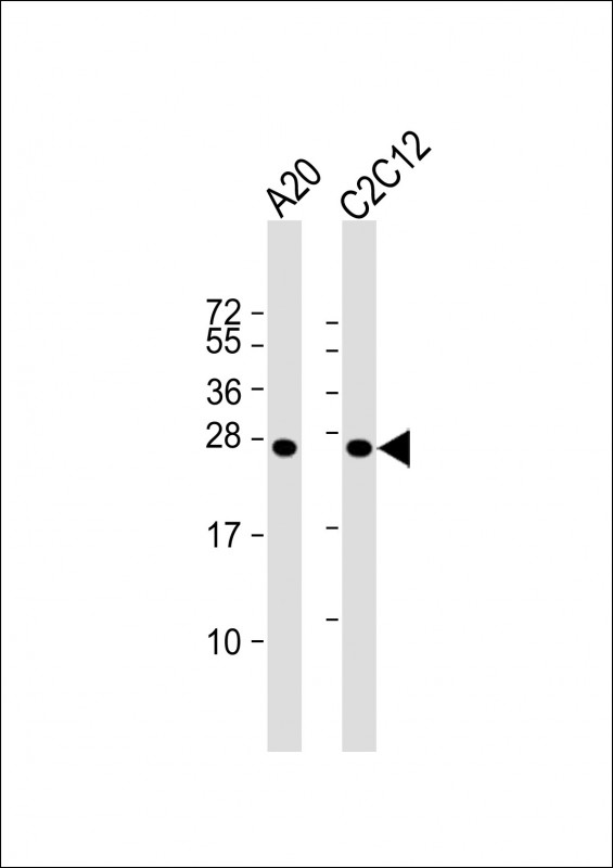 Rabbit Polyclonal Antibody to mouse BAD (Center S112/S111/Y113)