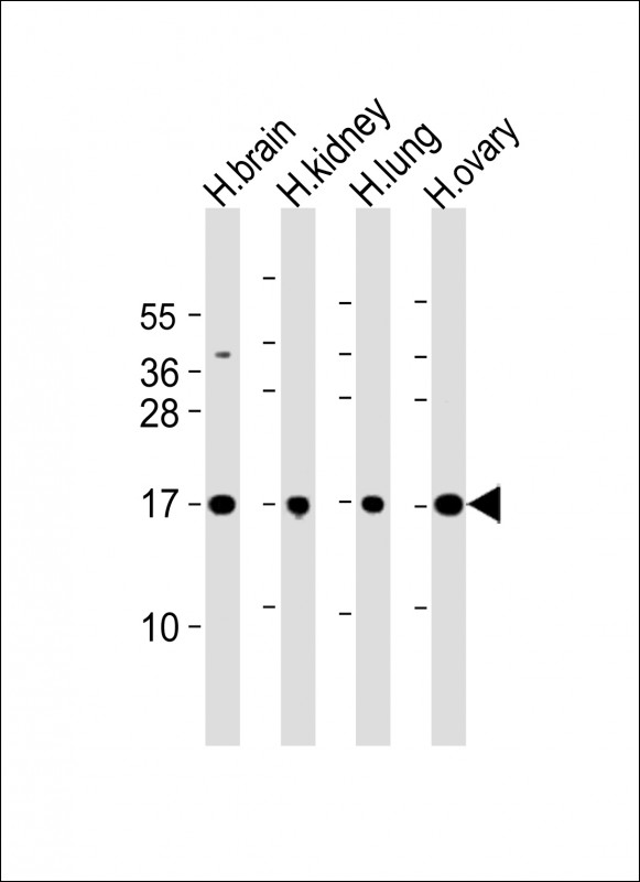 Rabbit Polyclonal Antibody to PPIAL4A