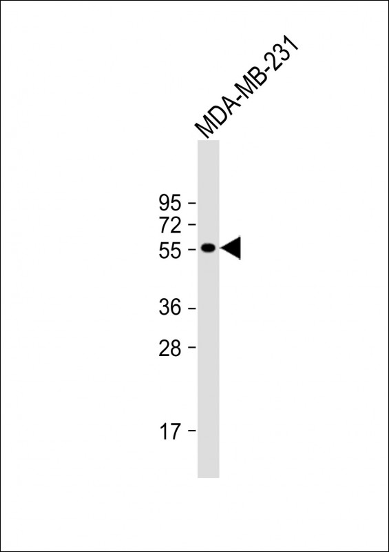 Rabbit Polyclonal Antibody to DMP1 (N-term)