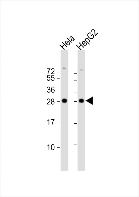 Rabbit Polyclonal Antibody to PMM2