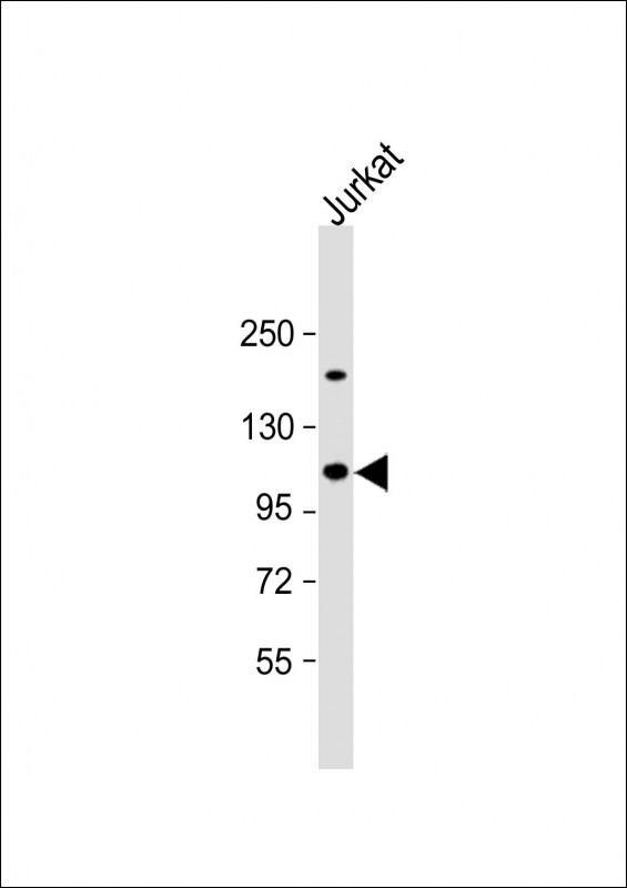 Rabbit Polyclonal Antibody to UBAP2L