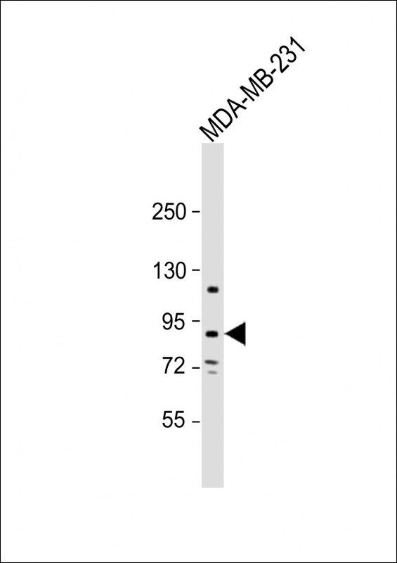 Rabbit Polyclonal Antibody to TROAP(N-term)