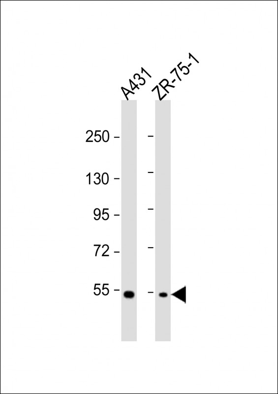 Rabbit Polyclonal Antibody to MEFV(Center)