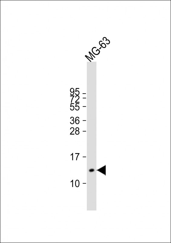 Rabbit Polyclonal Antibody to Osteocalcin (N-term)