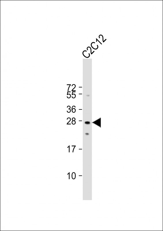 Rabbit Polyclonal Antibody to Mouse p27Kip1 (C-term T197)
