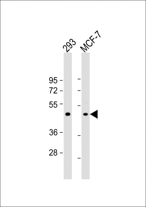 Rabbit Polyclonal Antibody to RARB