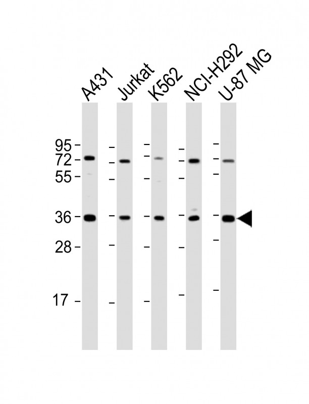 Rabbit Polyclonal Antibody to ETV7