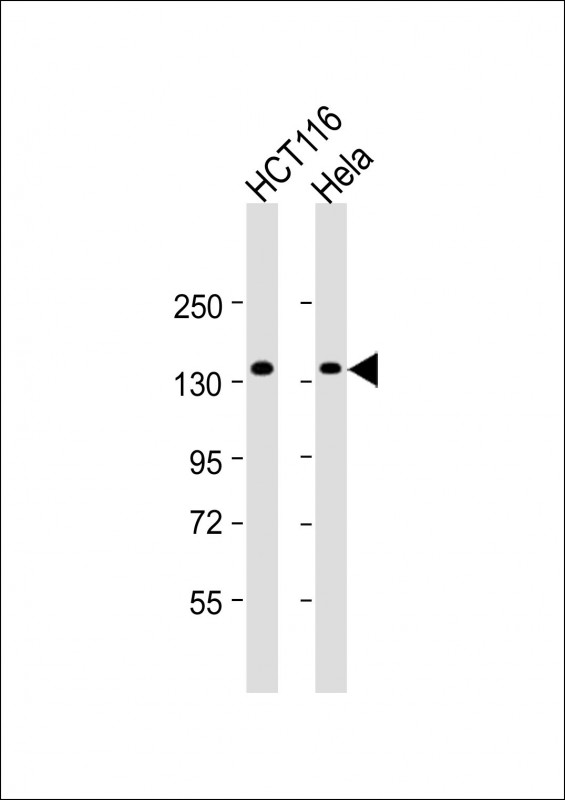 Rabbit Polyclonal Antibody to ANKS1A (N-term)