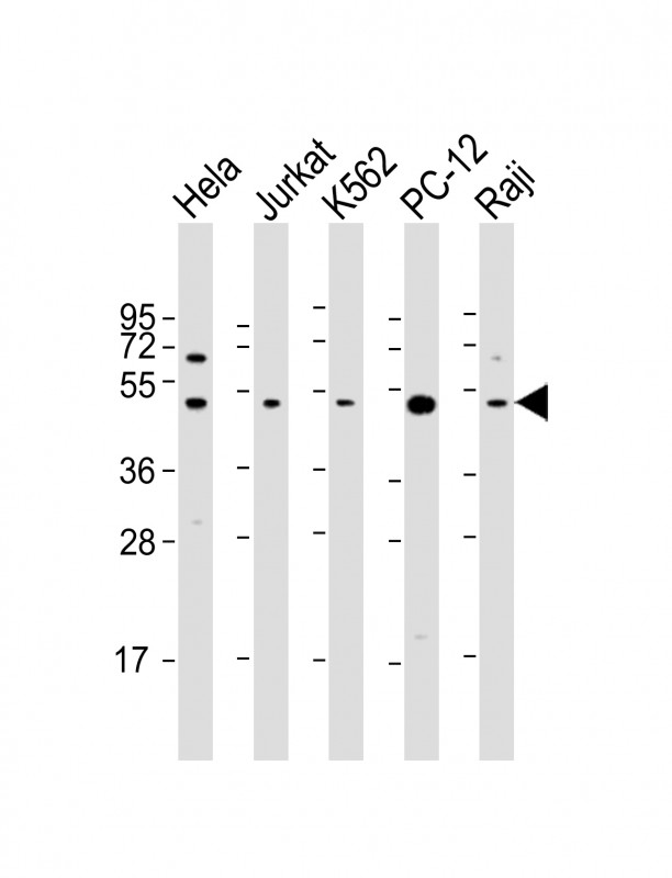 Rabbit Polyclonal Antibody to RPL4