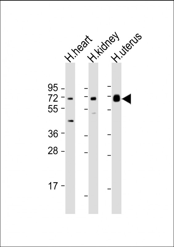 Rabbit Polyclonal Antibody to SPTLC3