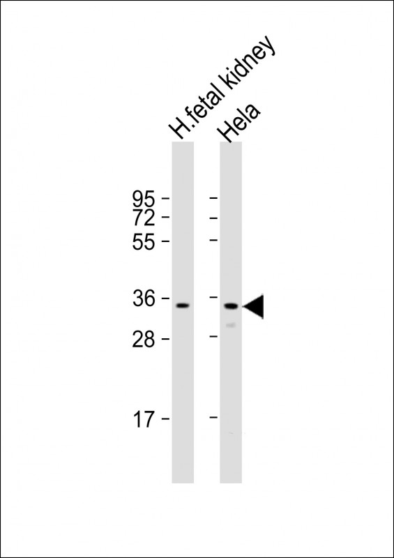 Rabbit Polyclonal Antibody to UPP1