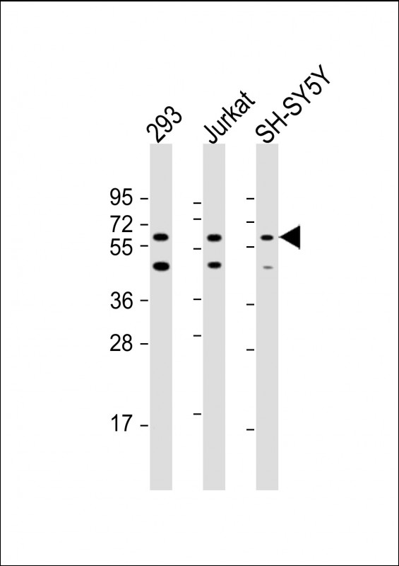 Rabbit Polyclonal Antibody to HEXDC (N-Term)