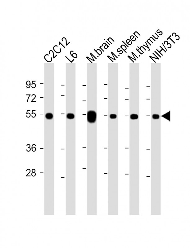 Rabbit Polyclonal Antibody to beta Tubulin