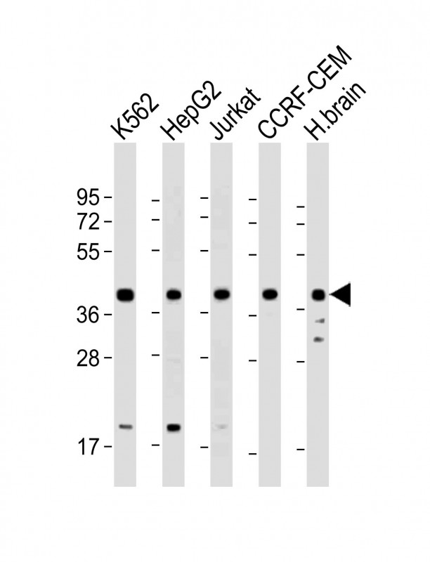 Rabbit Polyclonal Antibody to Cyclophilin D