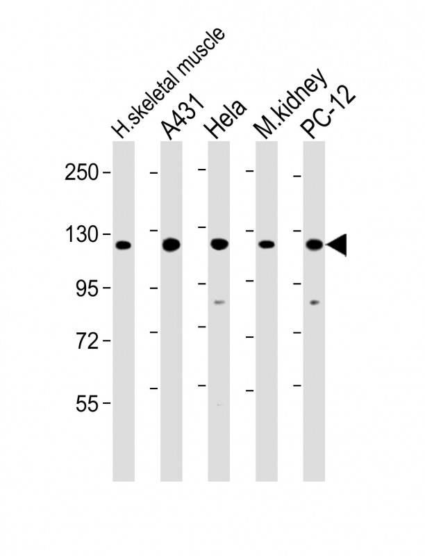 Rabbit Polyclonal Antibody to Vinculin