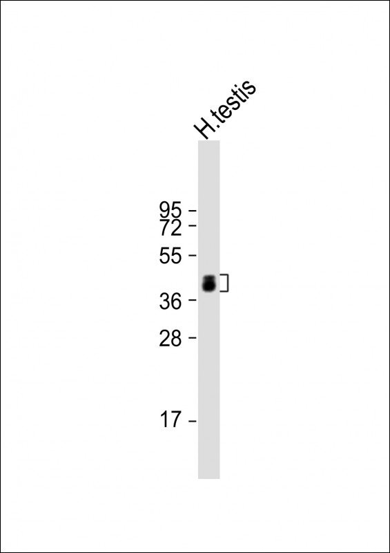 Rabbit Polyclonal Antibody to ART3