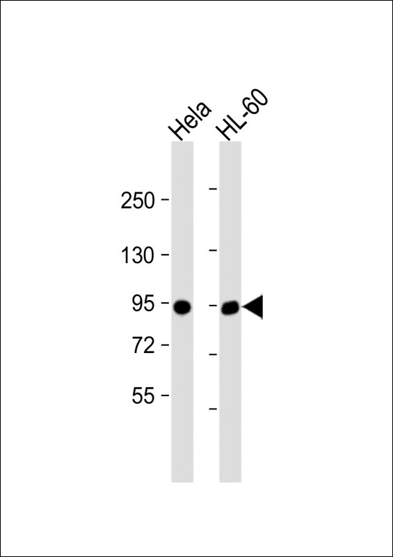 Rabbit Polyclonal Antibody to IL3RB (C-term V759)