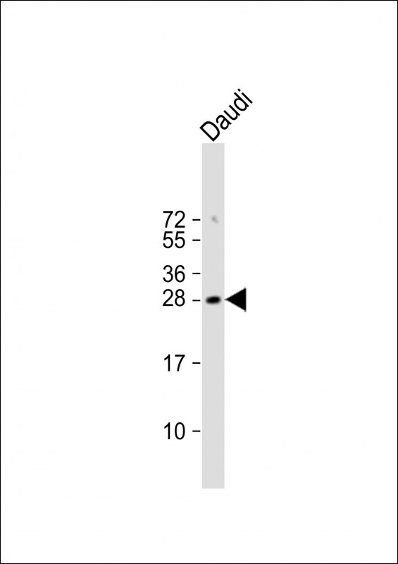 Rabbit Polyclonal Antibody to FAM3B (N-term)