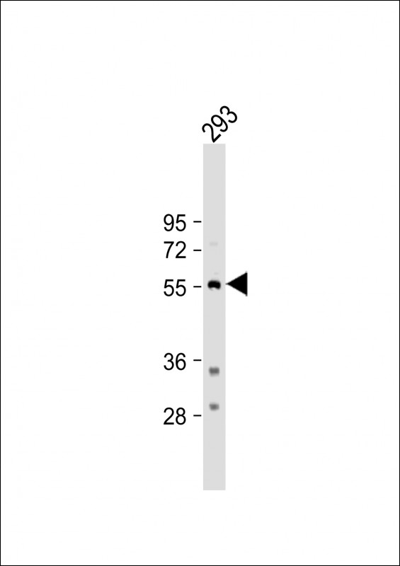 Rabbit Polyclonal Antibody to TPH1 (N-term)