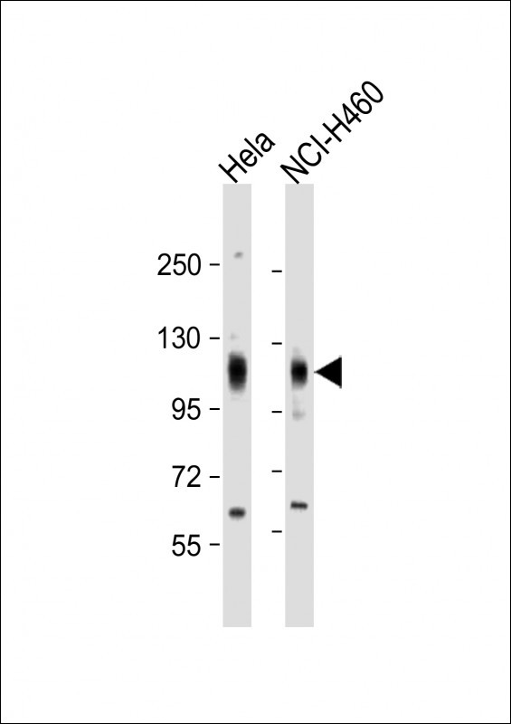 Rabbit Polyclonal Antibody to EphA4 (N-term)