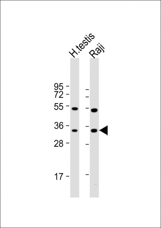 Rabbit Polyclonal Antibody to HSD17B3