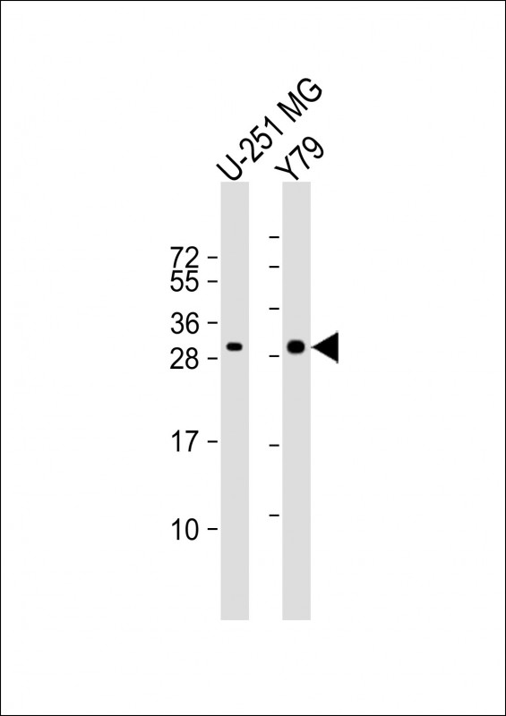 Rabbit Polyclonal Antibody to MAPK1IP1L