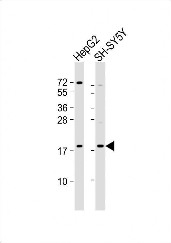 Mouse Monoclonal Antibody to GABARAP(Ascites)
