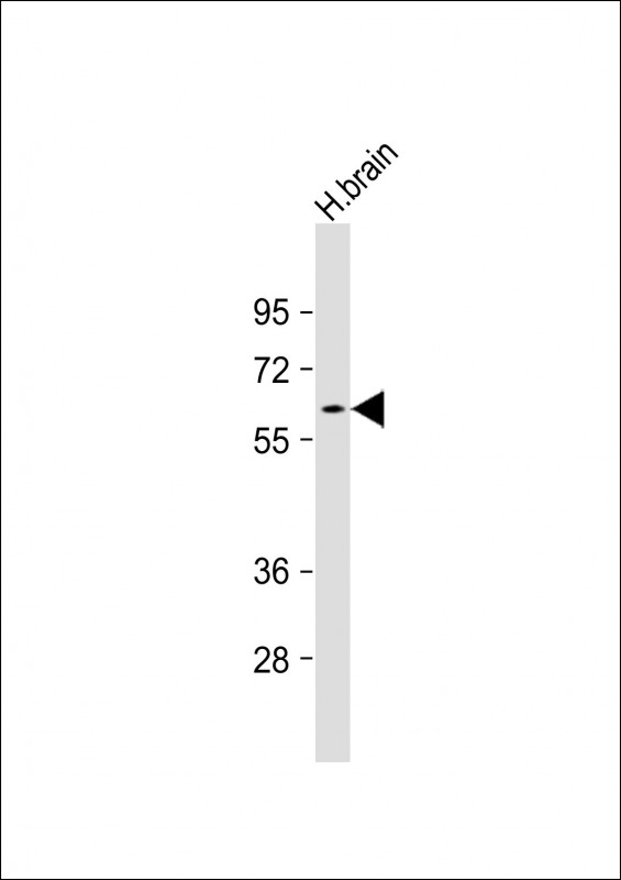 Mouse Monoclonal Antibody to GAD2