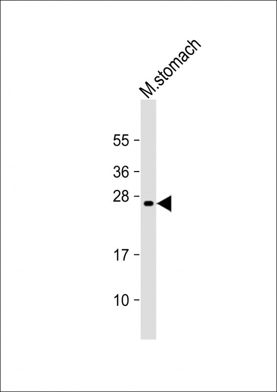 Mouse Monoclonal Antibody to RAB27B