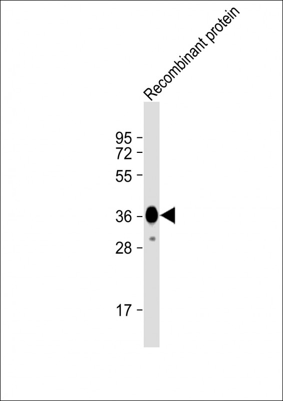 Mouse Monoclonal Antibody to MYO18B