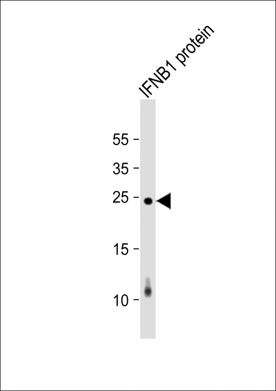 Mouse Monoclonal Antibody to IFNB1