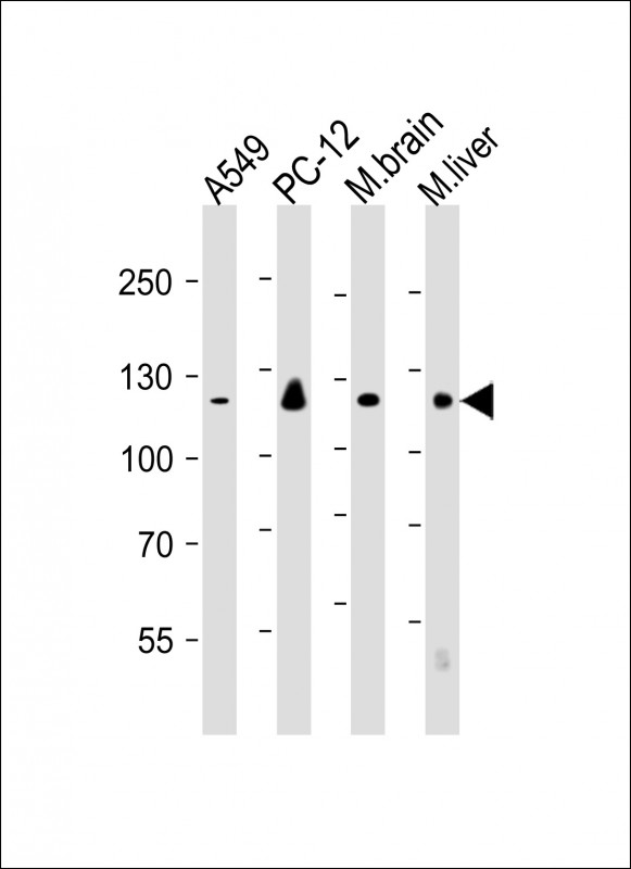 Mouse Monoclonal Antibody to EIF2AK3