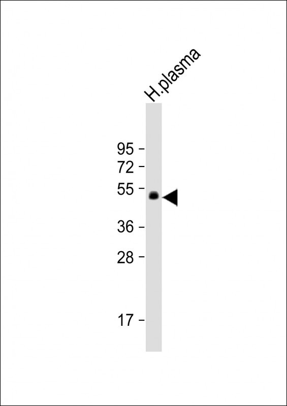Rabbit Polyclonal Antibody to PROC