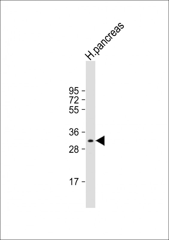 Rabbit Polyclonal Antibody to GNMT