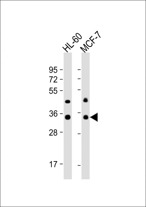 Rabbit Polyclonal Antibody to OR10J5