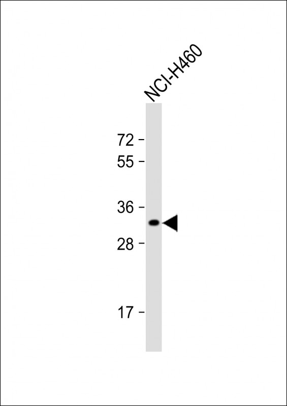 Rabbit Polyclonal Antibody to OR2B11