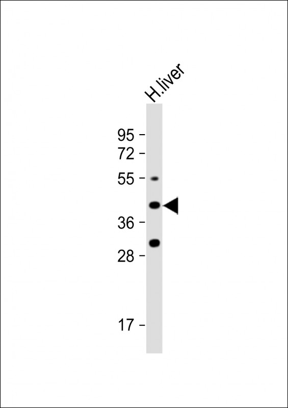 Rabbit Polyclonal Antibody to FADS6