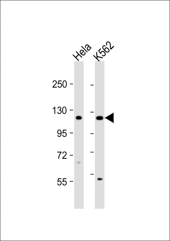 Rabbit Polyclonal Antibody to DDX11