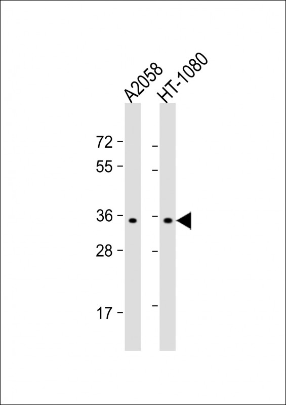 Rabbit Polyclonal Antibody to OR7G1 (N-term)