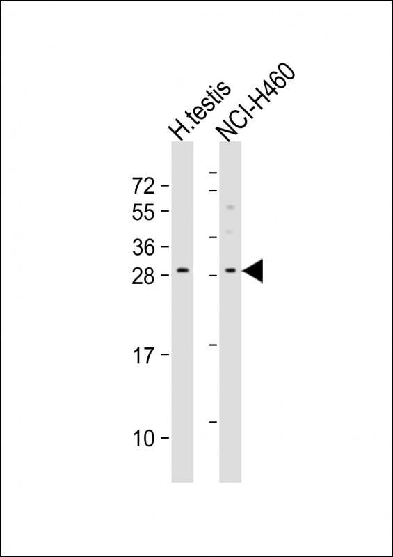 Rabbit Polyclonal Antibody to LCN9 (N-term)