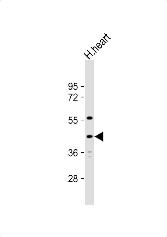 Rabbit Polyclonal Antibody to SAMD8 (N-term)