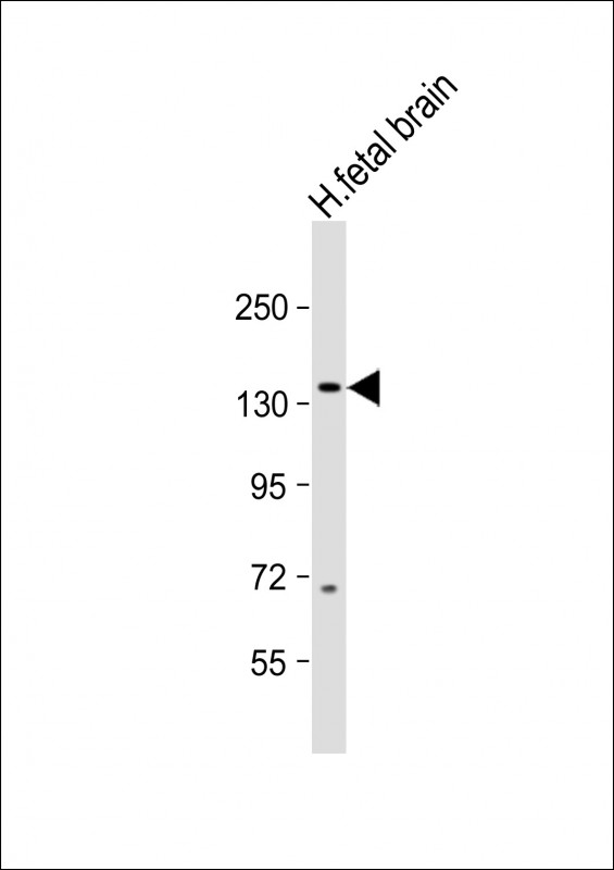 Rabbit Polyclonal Antibody to MAP3K15 (N-term)