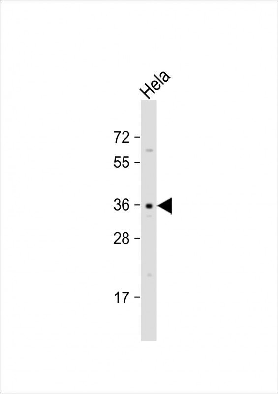 Rabbit Polyclonal Antibody to OR52E2