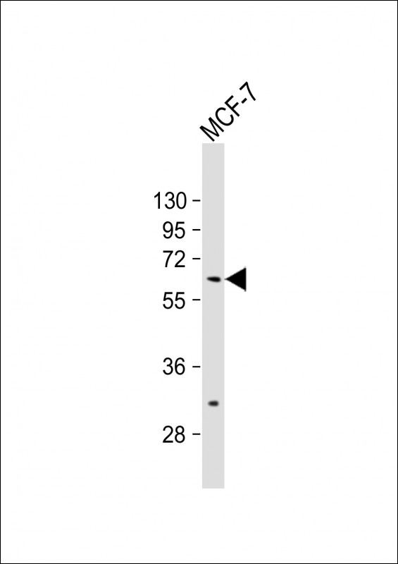 Rabbit Polyclonal Antibody to ZNF835 (N-term)
