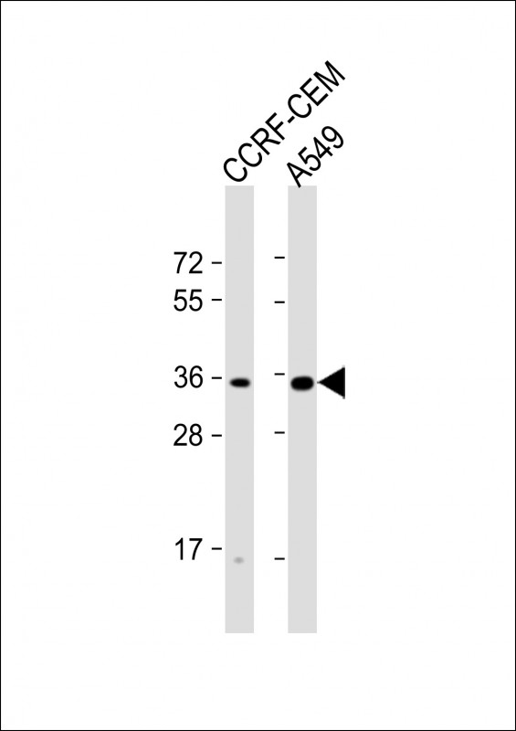 Rabbit Polyclonal Antibody to OR2A42