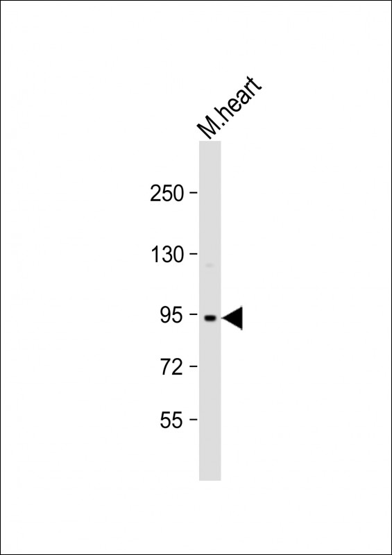 Rabbit Polyclonal Antibody to Mouse TRPV3 (N-term)