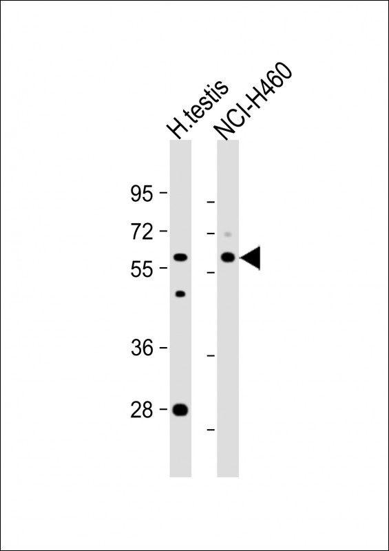 Rabbit Polyclonal Antibody to GTF2A1L