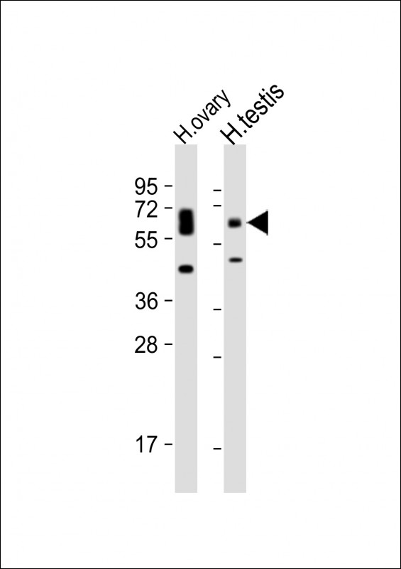 Rabbit Polyclonal Antibody to POTE (C-term L446)